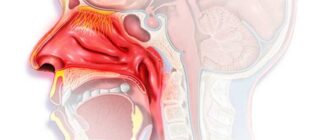 Ринофарингит: симптомы, причины, у детей, диагностика и лечение