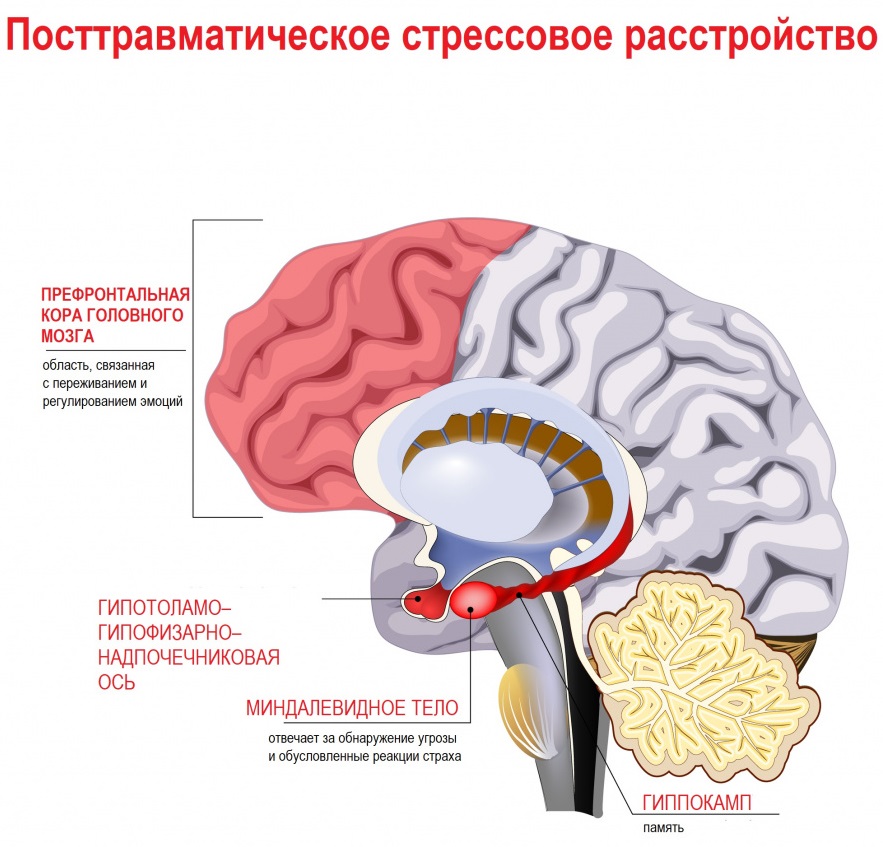 Патофизиология расстройства 